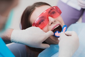 Cornerstone_dental-checkups-3